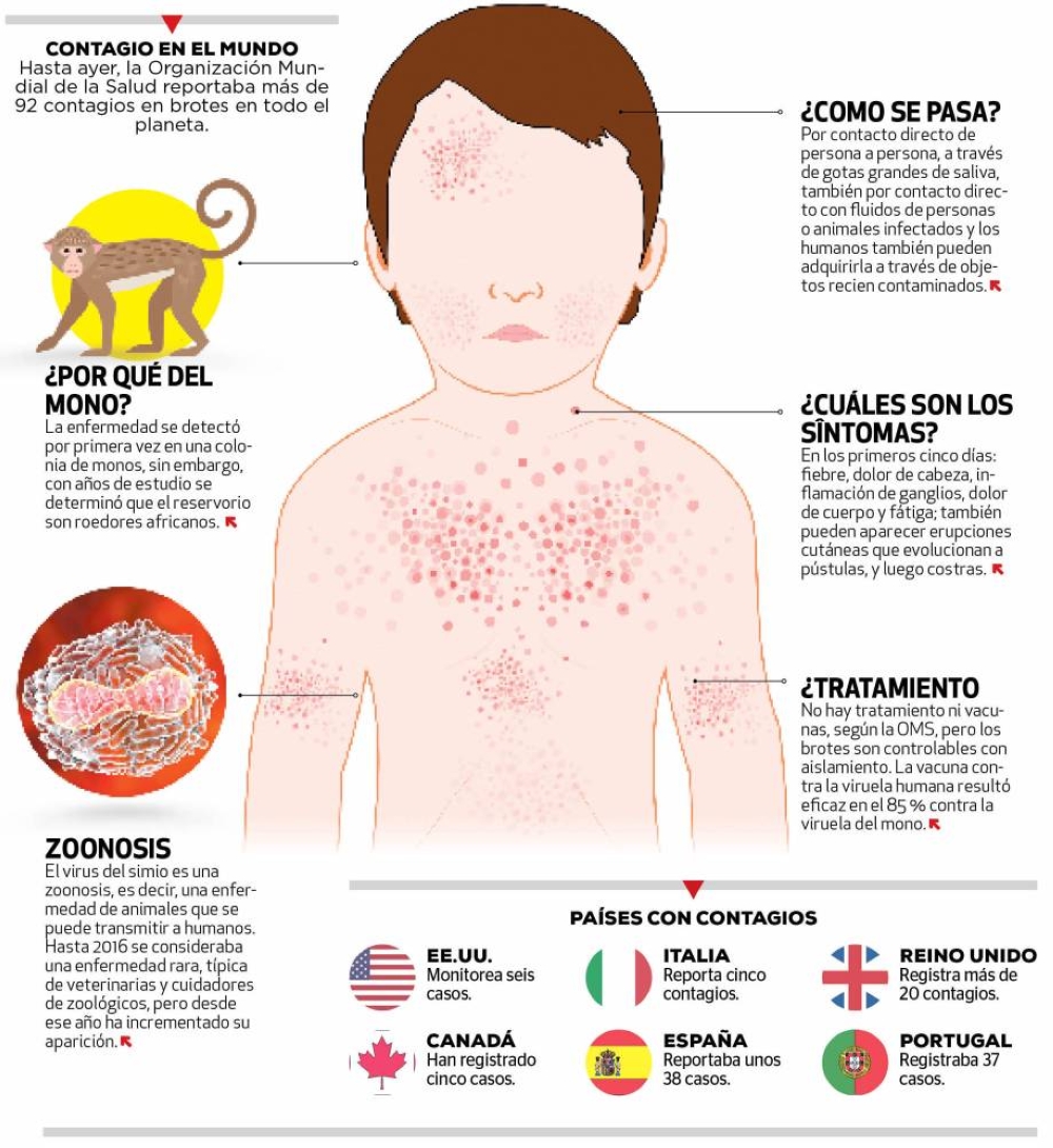 Infográfico sobre viruela del mono