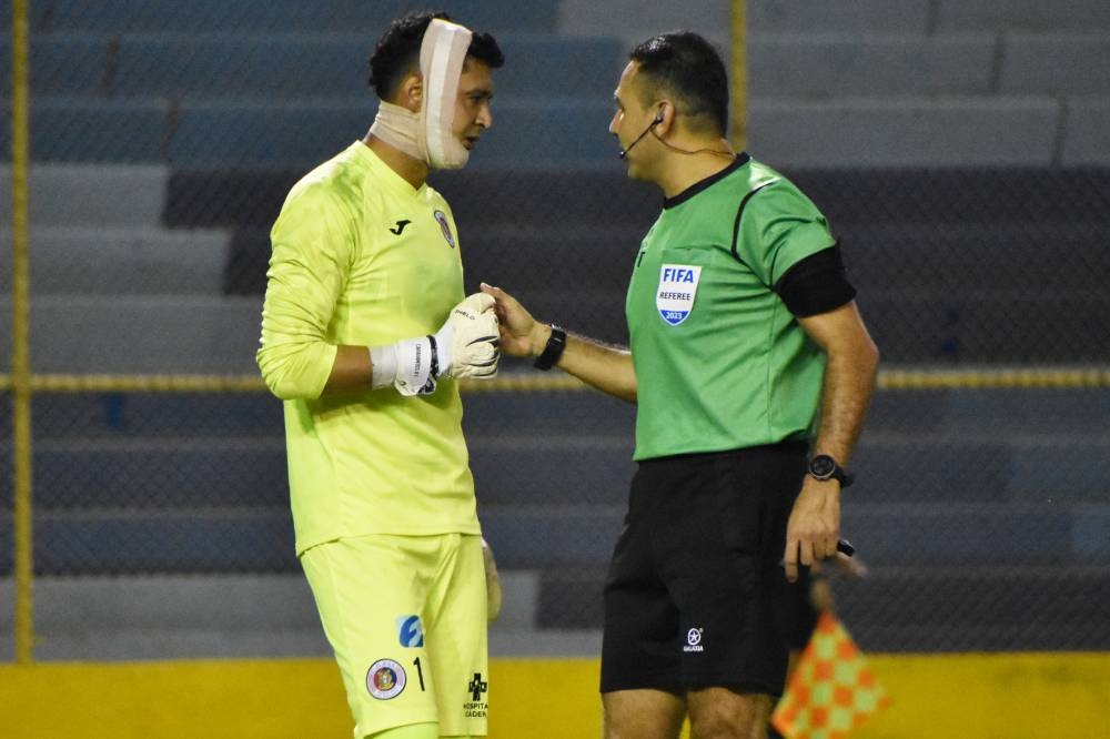 Kevin Carabantes disputó el clásico ante Águila con un insólito vendaje