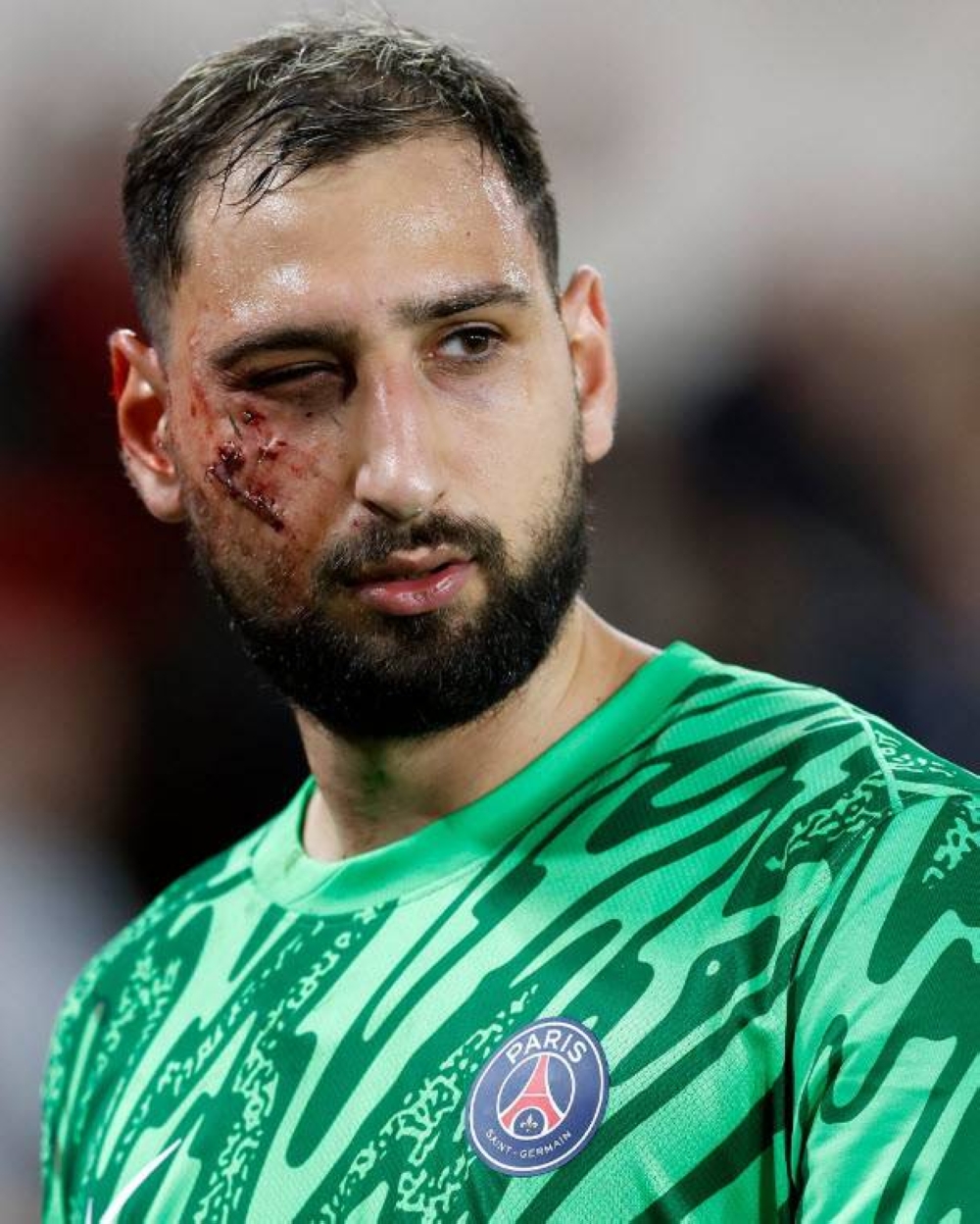 Así quedó el rostro del portero italiano del PSG.